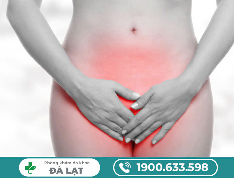 Hình ảnh minh họa