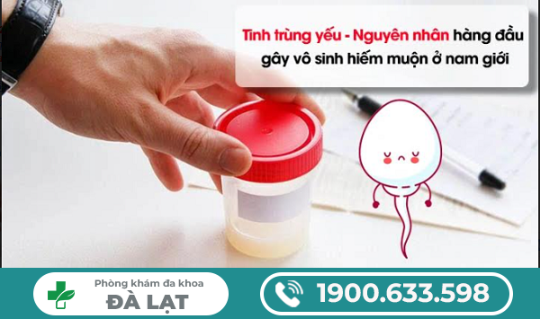 Hình ảnh minh họa