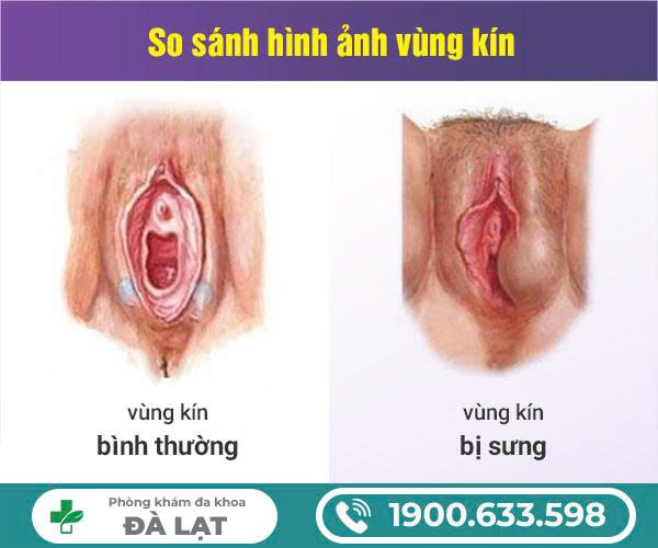 Hình ảnh minh họa