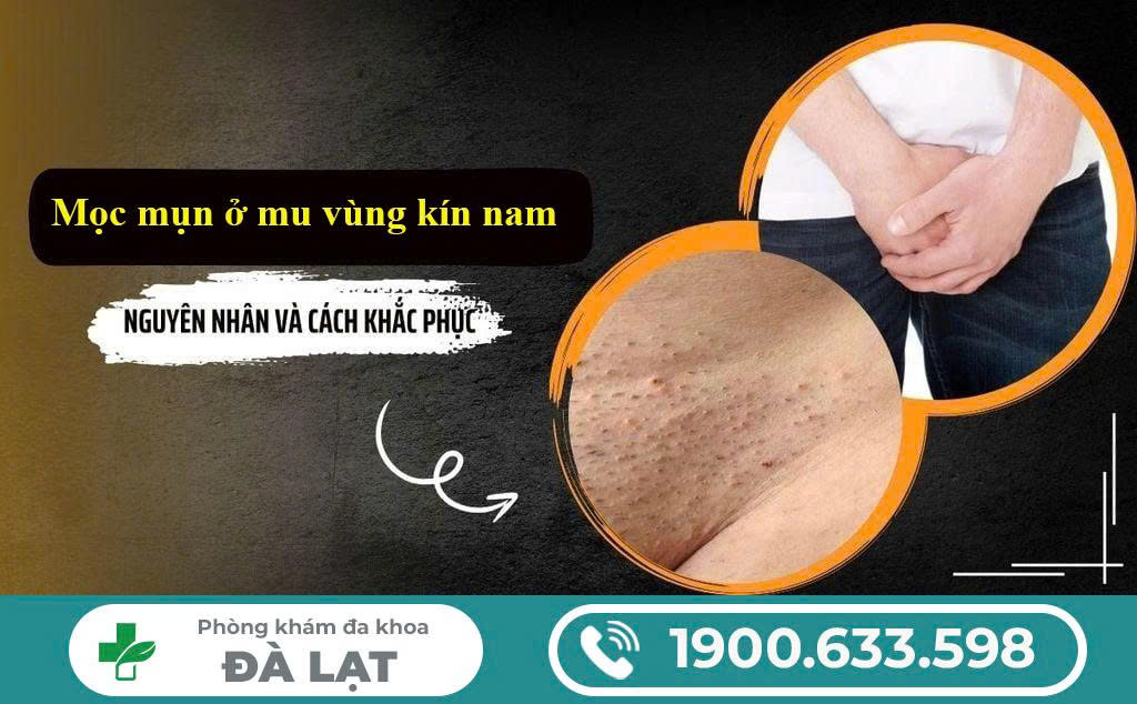 Hình ảnh minh họa