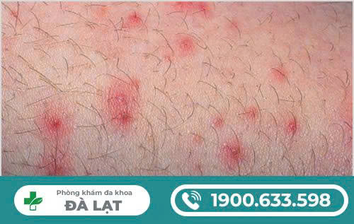 Hình ảnh minh họa