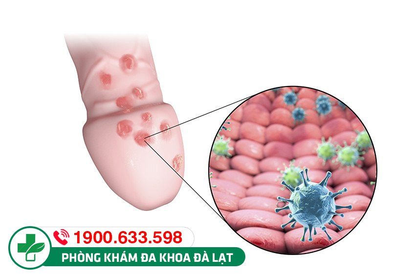 Hình ảnh minh họa