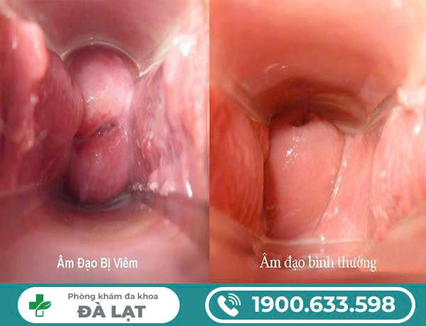 Hình ảnh minh họa