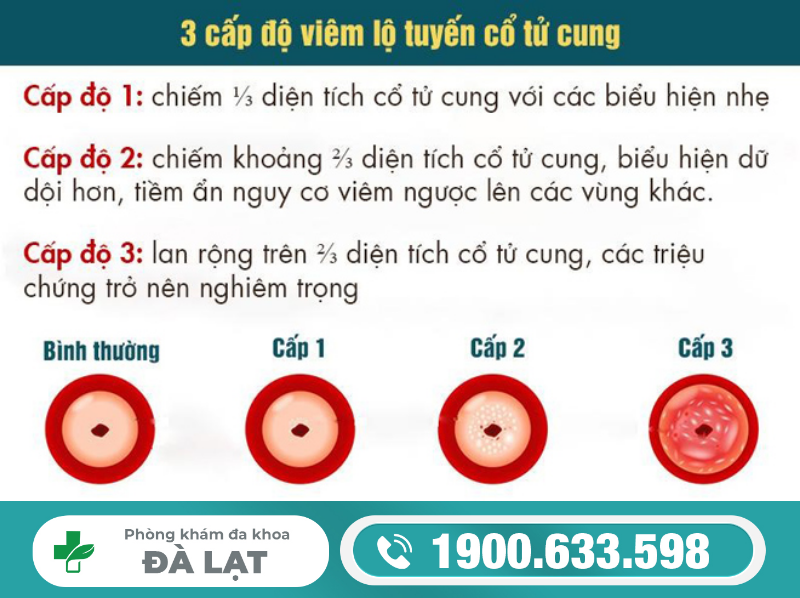 Hình ảnh minh họa