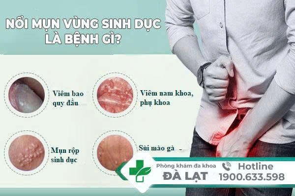 Hình ảnh minh họa