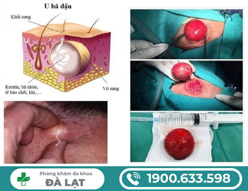 Hình ảnh minh họa