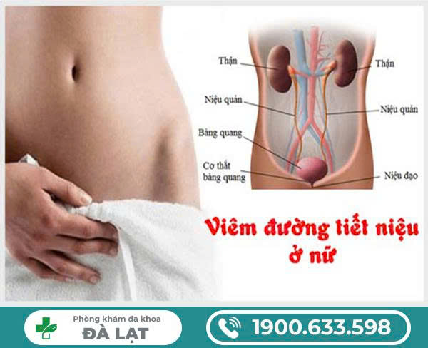 Hình ảnh minh họa