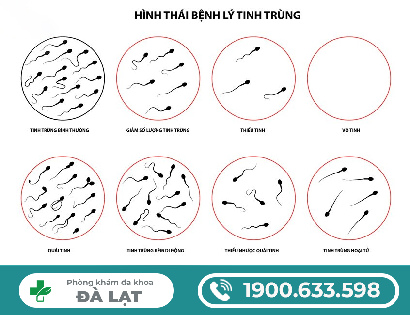 Hình ảnh minh họa