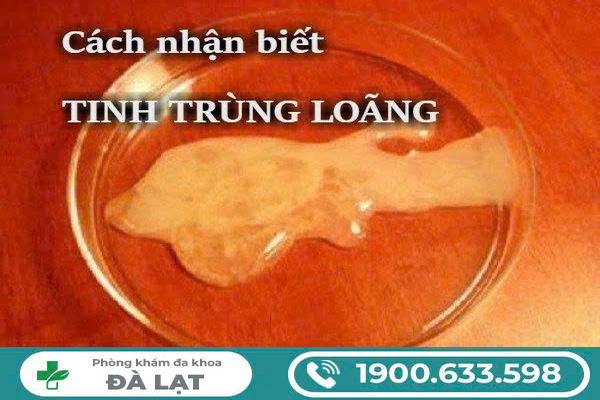 Hình ảnh minh họa