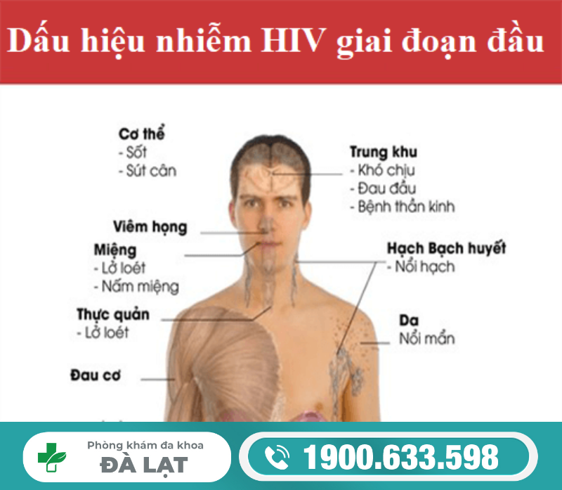 Hình ảnh minh họa