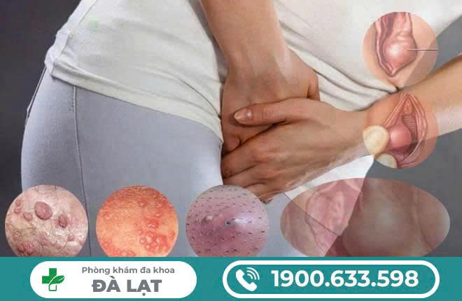 Hình ảnh minh họa