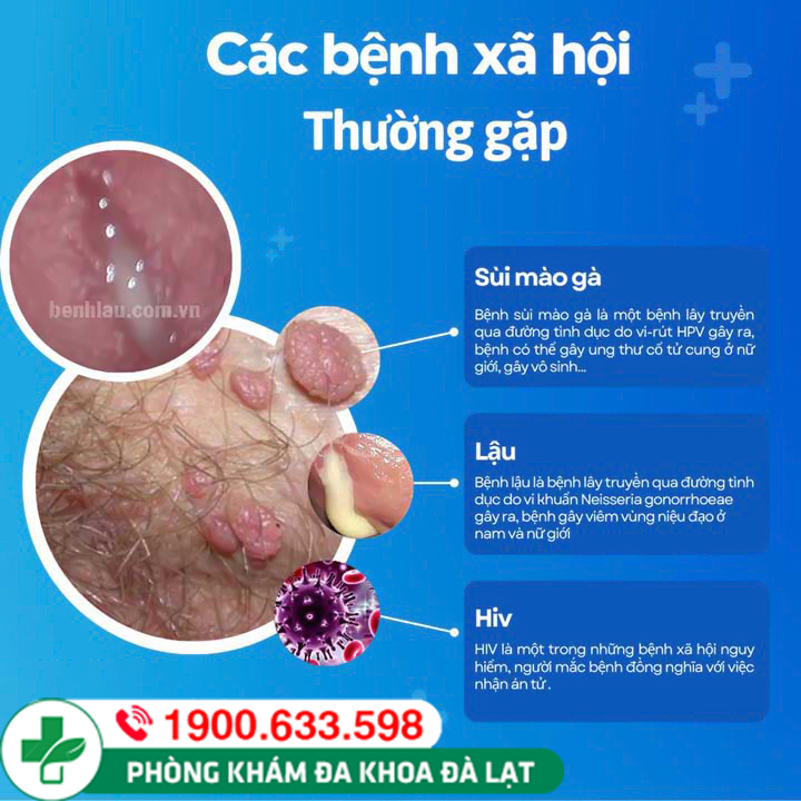 Hình ảnh minh họa