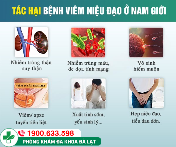 Hình ảnh minh họa