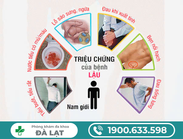 Hình ảnh minh họa