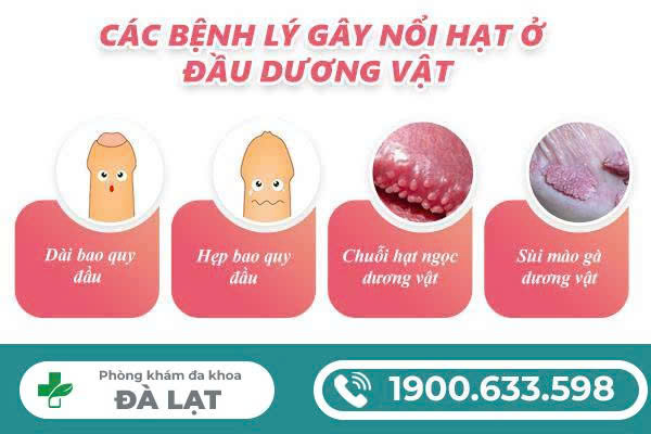 Hình ảnh minh họa