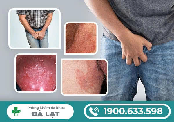 Hình ảnh minh họa