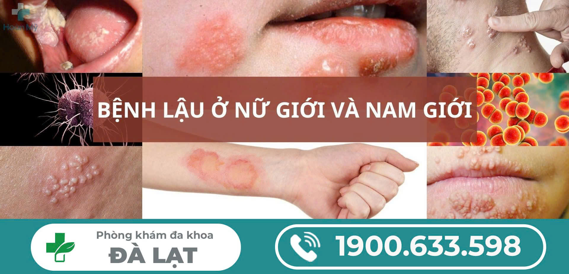 Hình ảnh minh họa