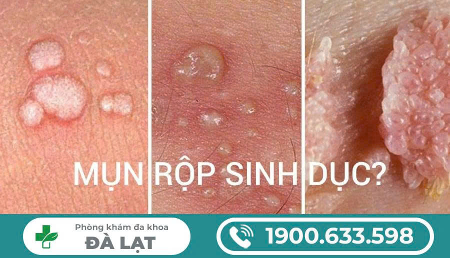 Hình ảnh minh họa