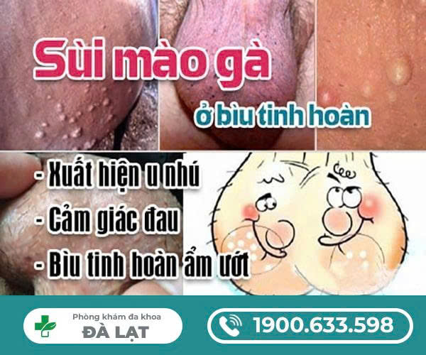 Hình ảnh minh họa