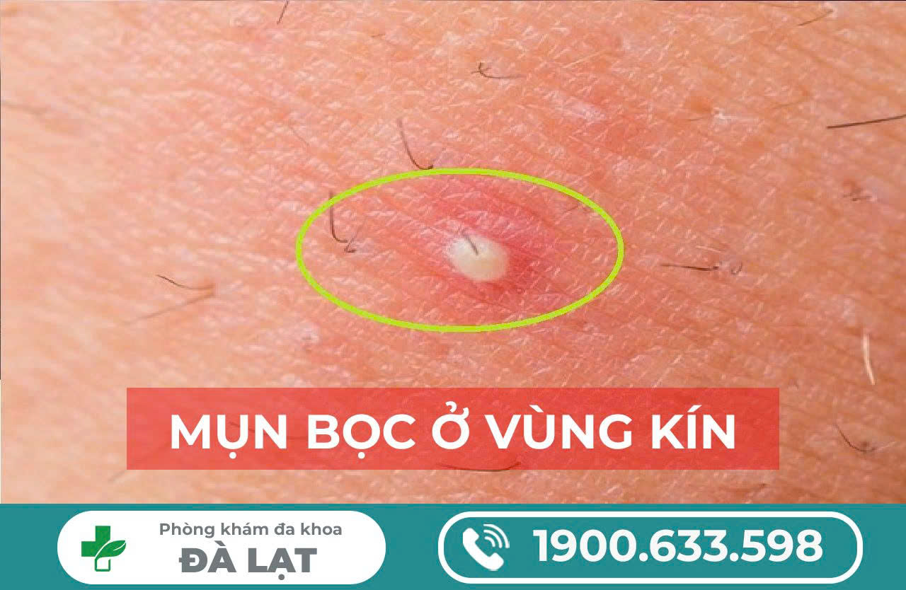 Hình ảnh minh họa