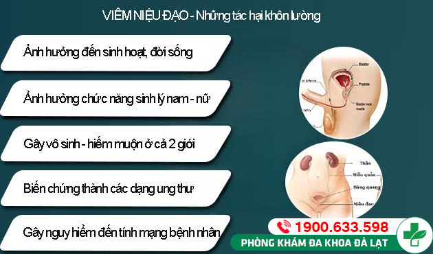 Hình ảnh minh họa