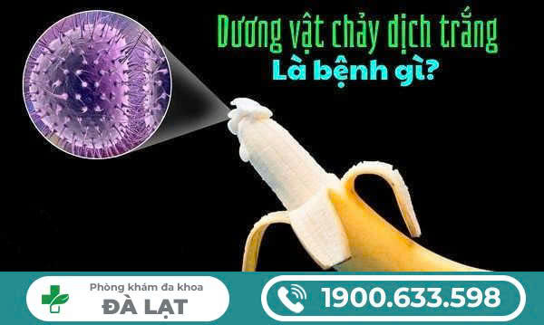 Hình ảnh minh họa