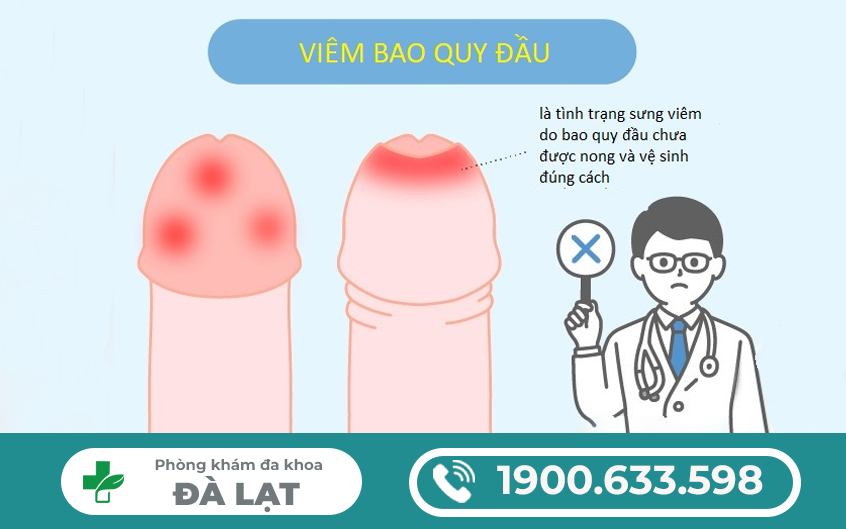 Hình ảnh minh họa