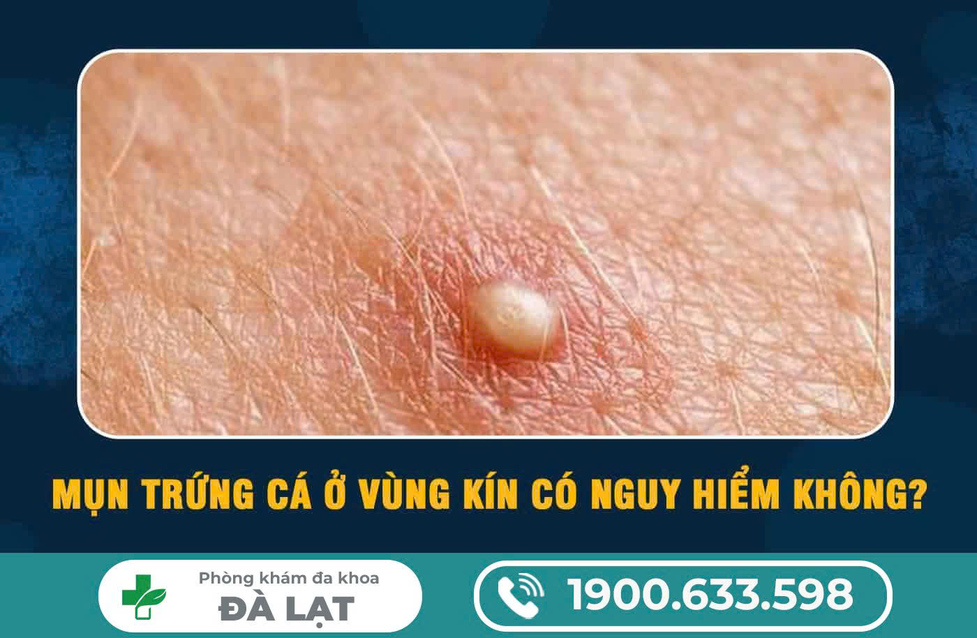 Hình ảnh minh họa