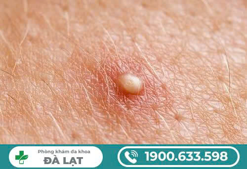 Hình ảnh minh họa