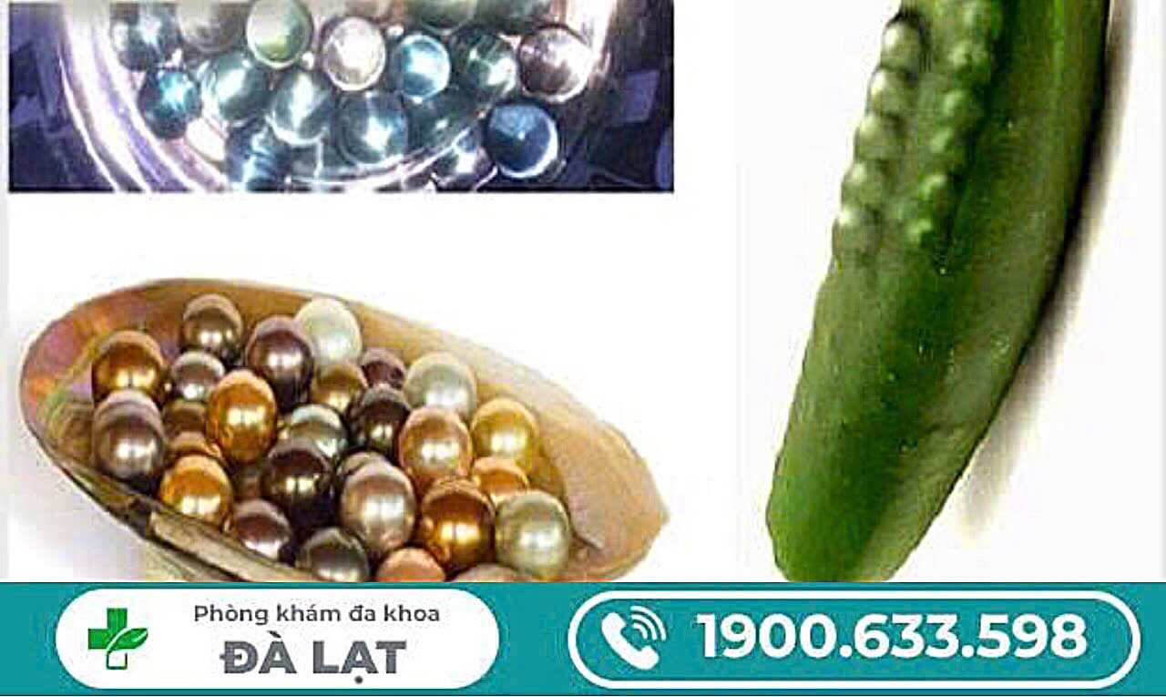 Hình ảnh minh họa