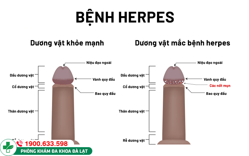 Hình ảnh minh họa