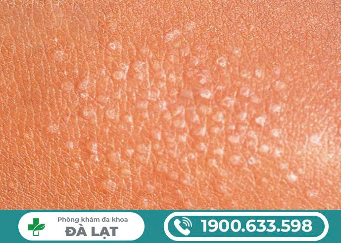 Hình ảnh minh họa