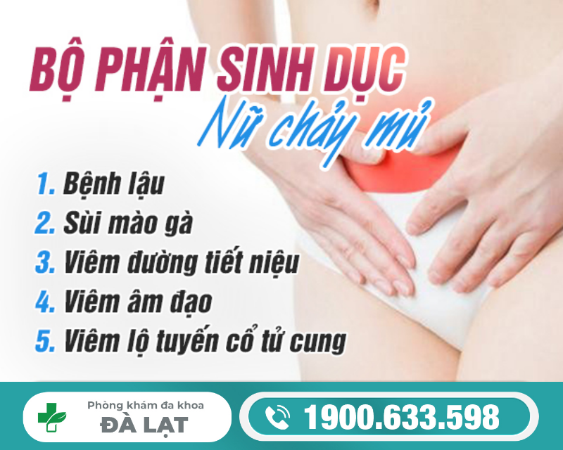 Hình ảnh minh họa