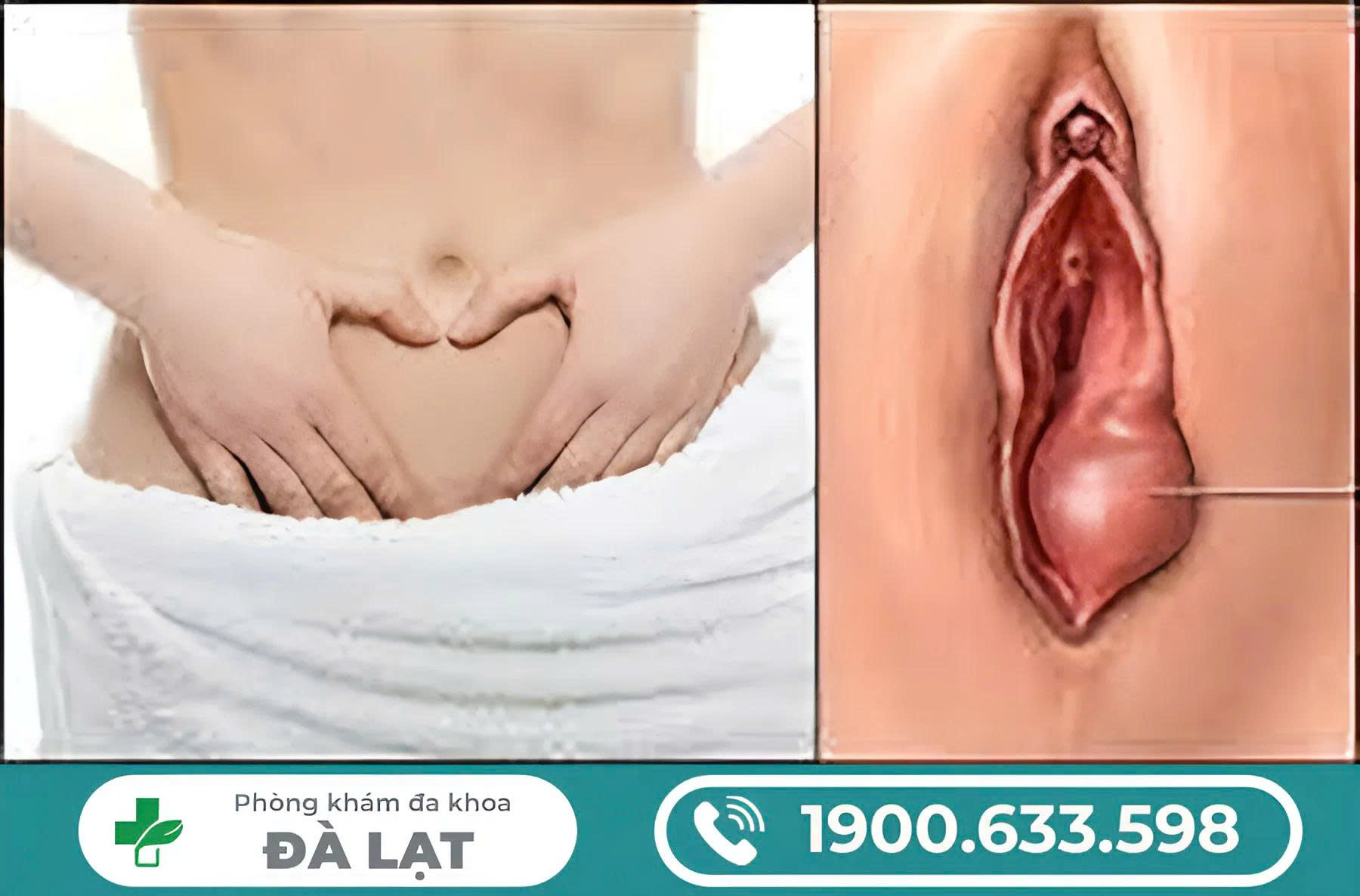 Hình ảnh minh họa