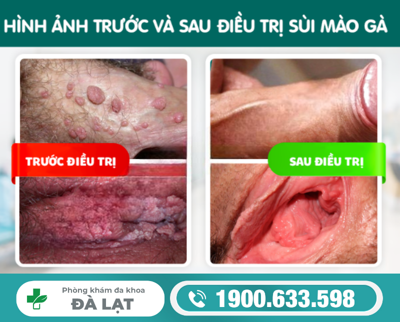 Hình ảnh minh họa