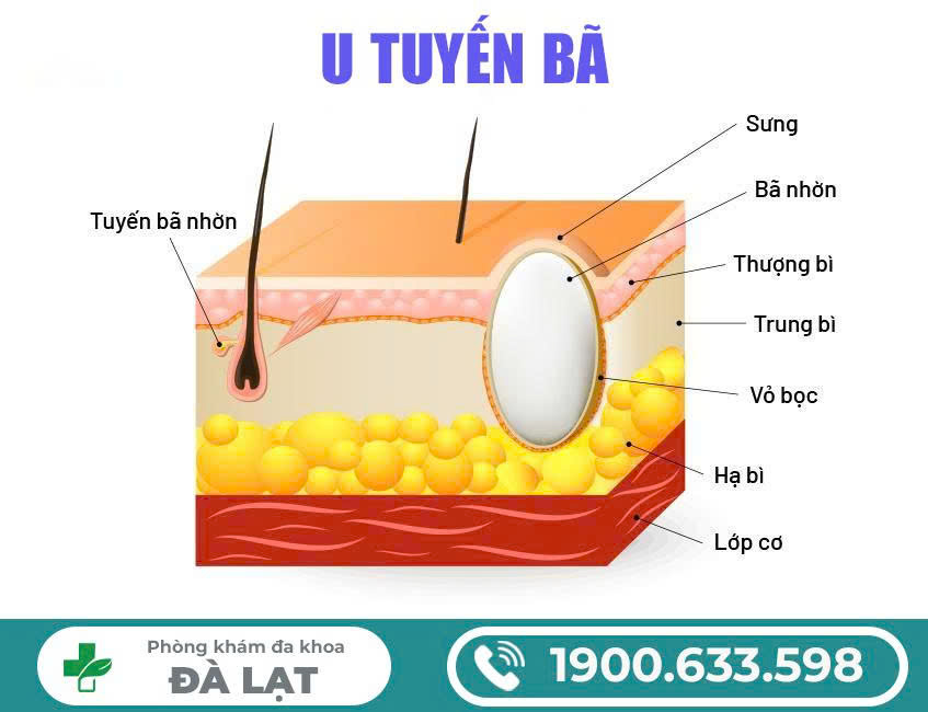 Hình ảnh minh họa