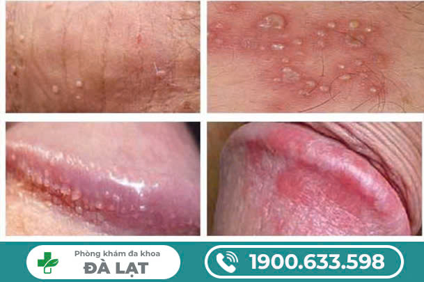 Hình ảnh minh họa