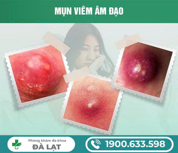 Hình ảnh minh họa