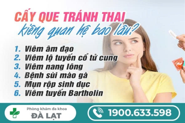 Hình ảnh minh họa