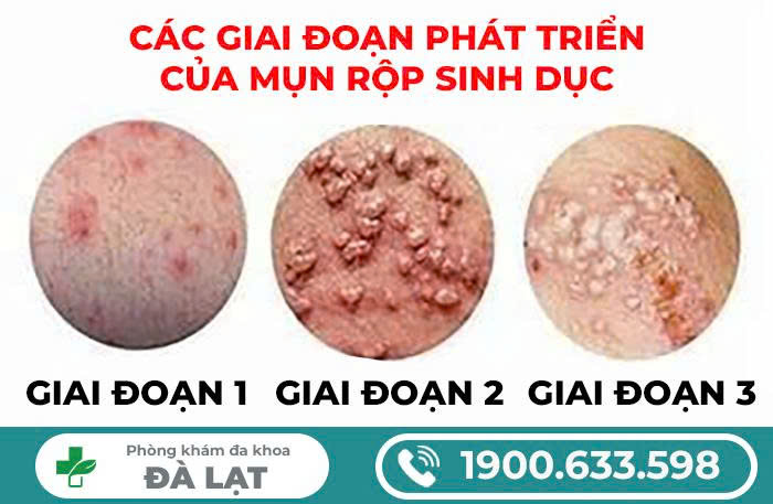 Hình ảnh minh họa