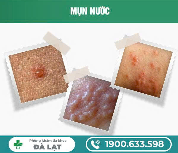 Hình ảnh minh họa