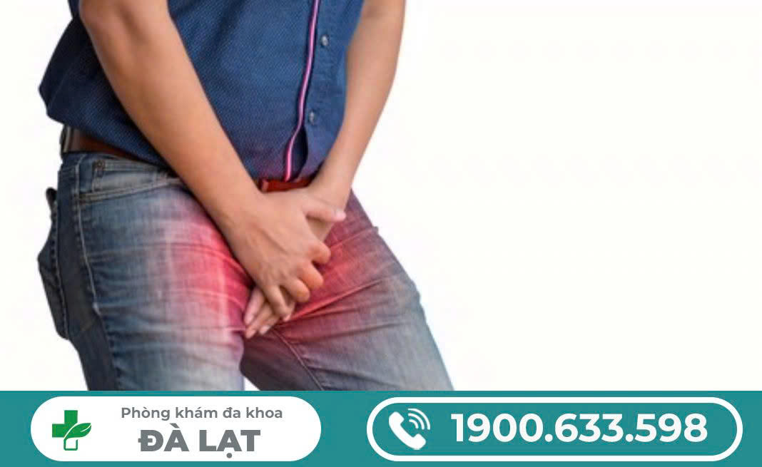 Hình ảnh minh họa