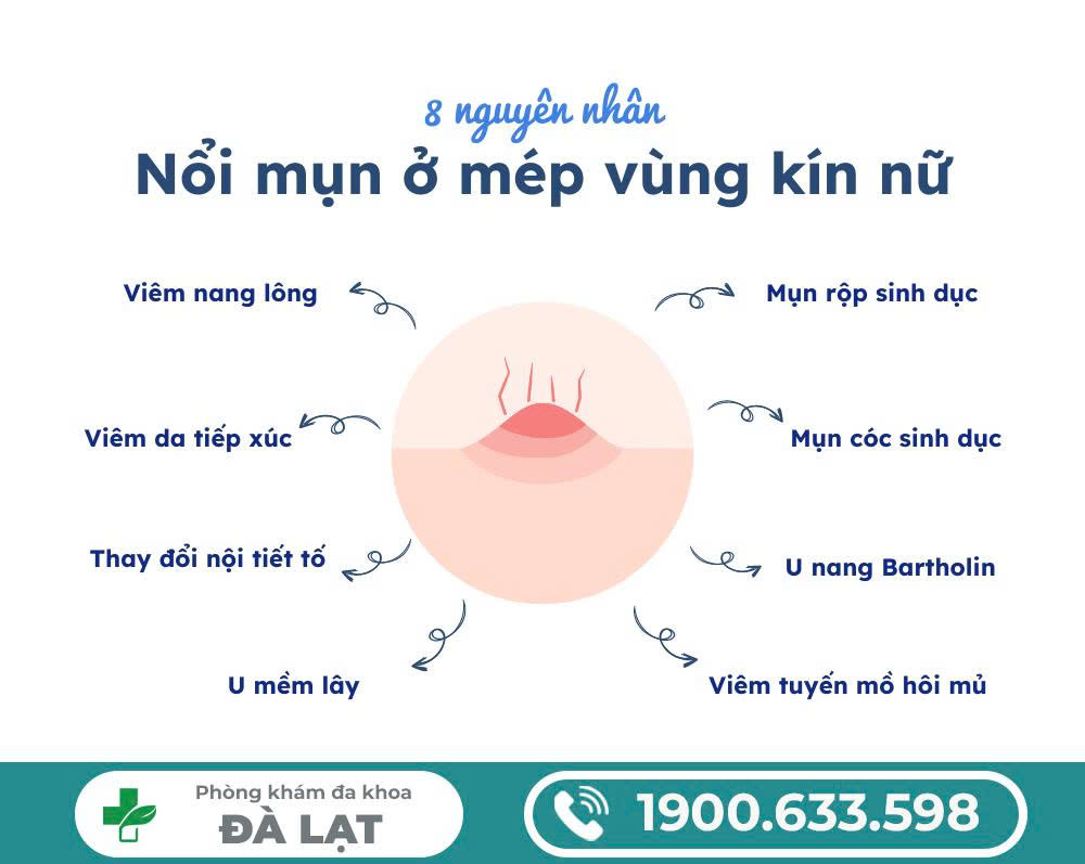 Hình ảnh minh họa