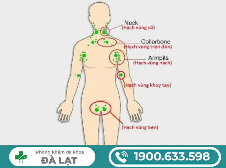 Hình ảnh minh họa