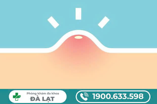 Hình ảnh minh họa