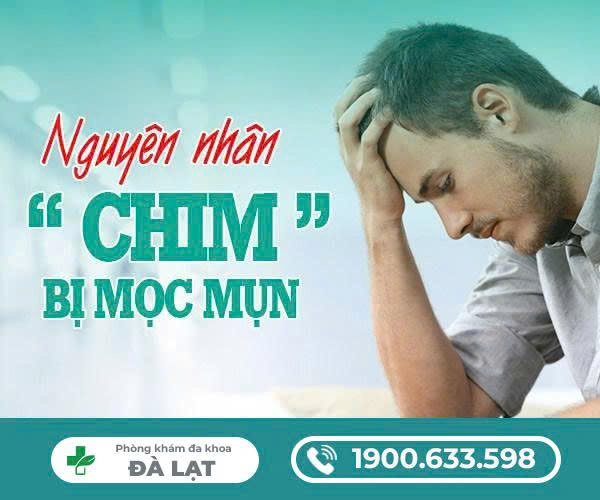 Hình ảnh minh họa