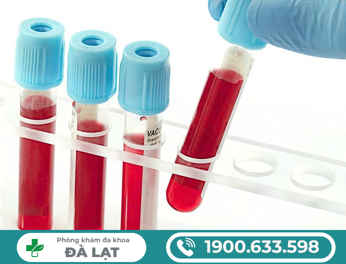 Hình ảnh minh họa