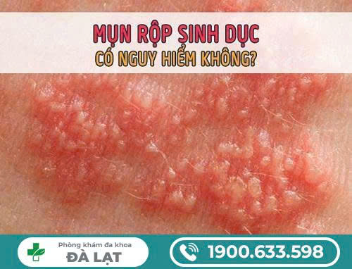 Hình ảnh minh họa