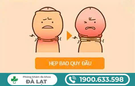 Hình ảnh minh họa