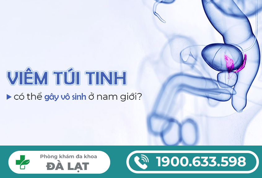 Hình ảnh minh họa